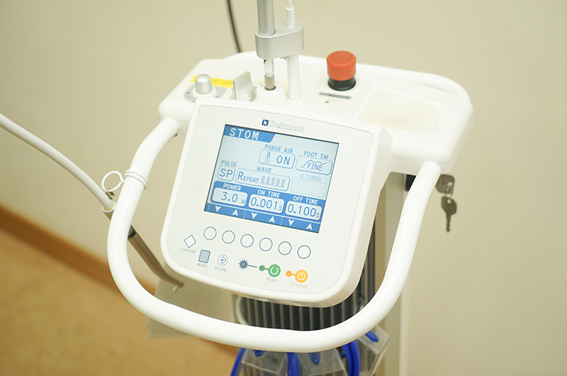 炭酸ガスレーザー