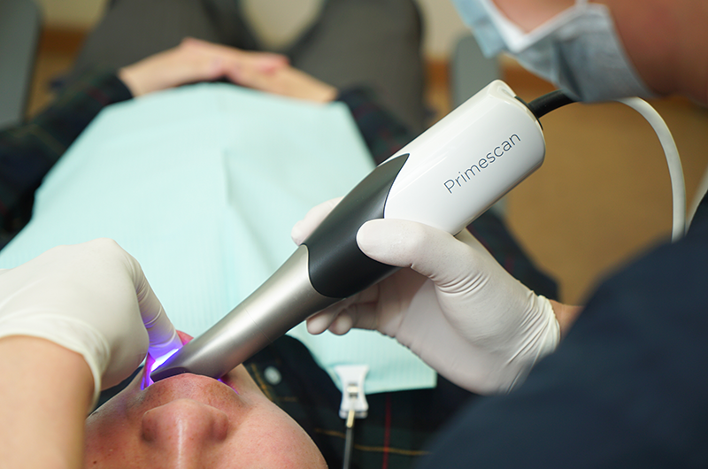 口腔内スキャナ